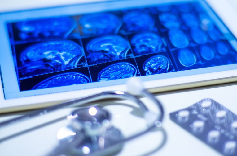 Tablet screen displaying multiple blue-toned brain scan images in various angles and sections. In the foreground, a stethoscope and a silver blister pack of pills are slightly out of focus on a white surface.